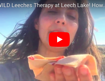 Leech Therapy with Wild Leeches at the Lake! Терапия с диви пиявици от Пиявичното Езеро! from Tsetsi on Vimeo.